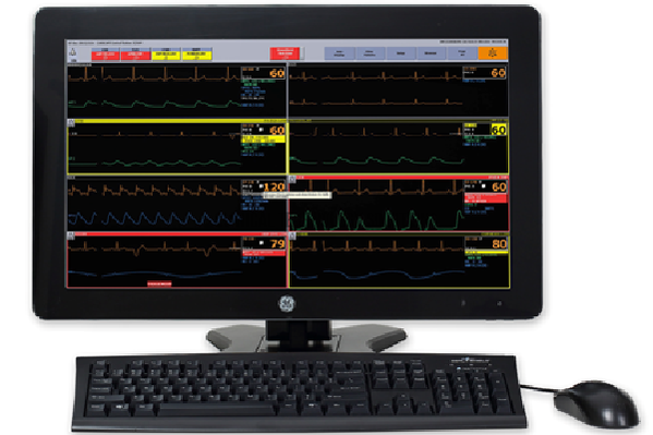 CTS HERO KIT for GE HealthCare CIC's & Telemetry Servers